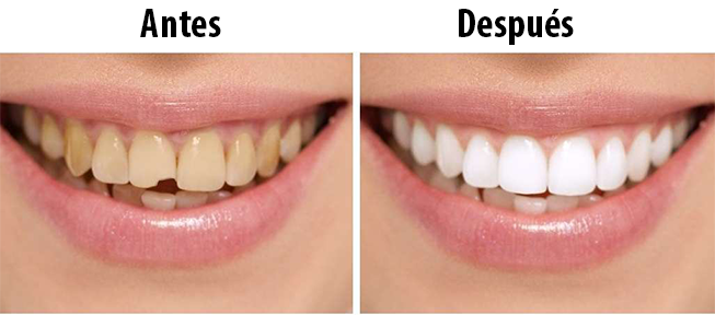 clinica-dental-antonio-perez-bas-odontologia-estetica-1